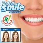 طقم أسنان علوي Perfect Smile قابل للإزالة – ابتسامة فورية بشكل طبيعي