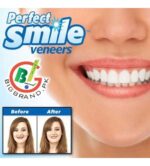 طقم أسنان علوي Perfect Smile قابل للإزالة – ابتسامة فورية بشكل طبيعي