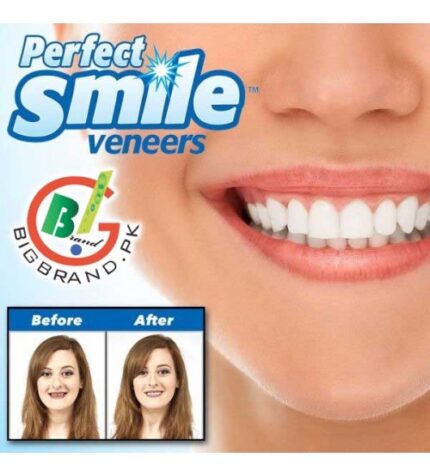 طقم أسنان علوي Perfect Smile قابل للإزالة – ابتسامة فورية بشكل طبيعي